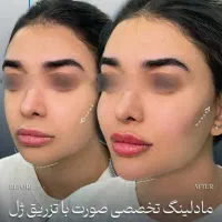 جشنواره ۵۰ درصد تخفیف ژل لب بوتاکس فیلر نخ لیفت|خدمات آرایشگری و زیبایی|اصفهان, رزمندگان|دیوار
