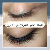 مژه و ابروتو طبیعی و دائمی زیبا کن