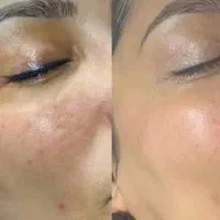 نماینده محصولات لاکچری کوین اصل فرانسه|آرایشی، بهداشتی، درمانی|شهریار, شهرک مصطفی خمینی|دیوار