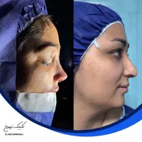 شرایط ویژه عمل بینی