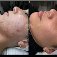 فیشال پاکسازی پوست