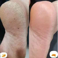 پدیکور و کاشت مژه
