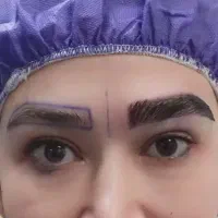 جشنواره کاشت ابرو ومو،بلفاروپلاستی،تخلیه غبغب