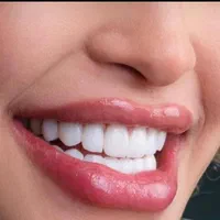 مرکزتخصصی عصبکشی وترمیم دندان در دندانپزشکی بینظیر|خدمات آرایشگری و زیبایی|شیراز, سینما سعدی|دیوار
