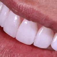 اجاره پروانه  دندانسازی یا بعنوان مسئول فنی