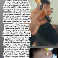 مزوتراپی‌ و PRP