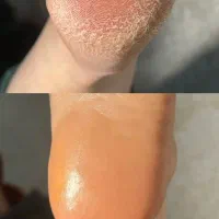 کفسابی/ پدیکور / + هدیه خفن|خدمات آرایشگری و زیبایی|اندیشه, اندیشه فاز ۱|دیوار