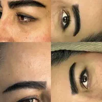 کاشت طبیعی و دائمی ابرو