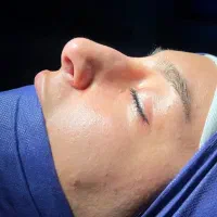 تخفیف ویژه جراحی بینی همین حالا|خدمات آرایشگری و زیبایی|تهران, ازگل|دیوار