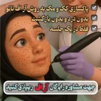 مرکز تخصصی حذف لک وکک ومک|خدمات آرایشگری و زیبایی|اهواز, پادادشهر|دیوار