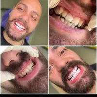 خدمات دندانپزشکی و کامپوزیت و زیبایی و درمانی