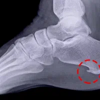 بادکش گرم و آگنی کارما.|خدمات آرایشگری و زیبایی|تهران, بهارستان|دیوار