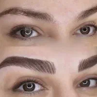 فرصتی برای داشتن چهره ای طبیعی و نچرال