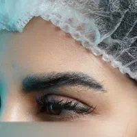 کاشت ابرو در مرکز تخصصی