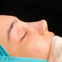 تخفیف عمل بینی لیپو ابدو لیفت ابرو وکاشت ابرو و مو|خدمات آرایشگری و زیبایی|اسلامشهر, شهرک لاله|دیوار