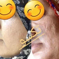 زیبایی درکنار تکسو