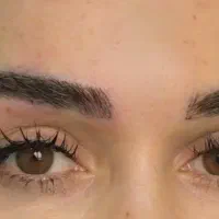میکروکاشت ابرو بدون جراحی