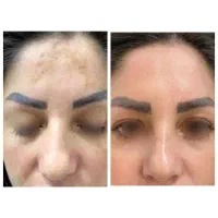 درمان قطعی مشکل مختلف پوست