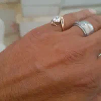 انگشتر ِاگرمی ۷