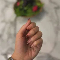 طلا