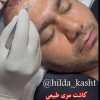 مدل کاشت مو و ابرو تضمینی جهت تولید محتوا|خدمات آرایشگری و زیبایی|شهریار, شهریار|دیوار