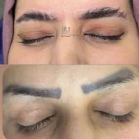 پاک کردن تاتو تضمینی با یکی الی دو جلسه