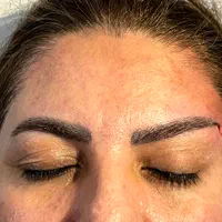نخ جوان ساز/کاگ مونو/لیفت صورت شقیقه/نوبل/مدی لیفت|خدمات آرایشگری و زیبایی|شیراز, پودنک|دیوار
