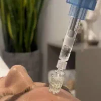 ژل بوتاکس وفشیال