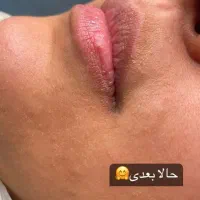 تخفیف یلدایی شیدینگ لب|خدمات آرایشگری و زیبایی|مشهد, شهید رضوی|دیوار