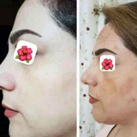 کرم اماراتی عصل مروه گلی