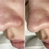 فیشیال تخصصی فقط چهارصد و نود هزار تومان|خدمات آرایشگری و زیبایی|آباده, |دیوار
