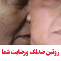 قویترین ضدلک و ضدجوش|آرایشی، بهداشتی، درمانی|دهلران, |دیوار