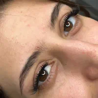 کاشت مژه هیدن