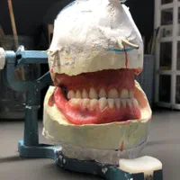 آموزش  دندانسازی مصنوعی به روش جدید.