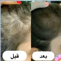 تونیک هیرفرند|آرایشی، بهداشتی، درمانی|اصفهان, ارداجی|دیوار