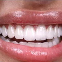 خدمات دندانپزشکی (بانرخ تامین اجتماعی )|خدمات آرایشگری و زیبایی|تبریز, |دیوار