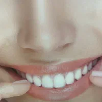 دندانسازی دنداپزشکی