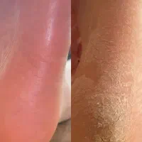 آف50درصدی آموزش و خدمات پدیکوردرمانی تا آخر ماه280|خدمات آرایشگری و زیبایی|آبادان, |دیوار