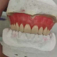 ( دندان سازی لبخند )|خدمات آرایشگری و زیبایی|زنجان, |دیوار