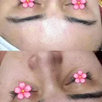 فیشیال تخصصی توسط پیراپزشک با۳۰٪تخفیف درکلینیک|خدمات آرایشگری و زیبایی|شیراز, خلدبرین|دیوار