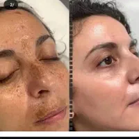 کرم معجزه صورت و کرم عربی دست و پا|آرایشی، بهداشتی، درمانی|داراب, |دیوار