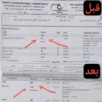 قند زیر 100 بدون قرص شیمیایی|خدمات آرایشگری و زیبایی|خرمشهر, |دیوار