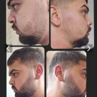 جاهای خالیتو. پوشش بده
