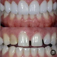 تخفیفهای ۳۰  درصدی به مدت ۱ هفته