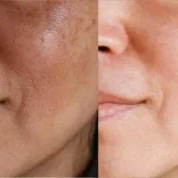 کلینیک زیبایی زکریا  خدمات تخصصی زیبایی|خدمات آرایشگری و زیبایی|مشهد, بهارستان|دیوار