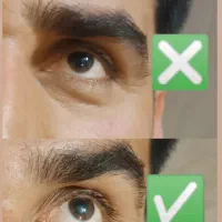 ژل و بوتاکس مزوتراپی و مزونیدلینگ آرایش دایم|خدمات آرایشگری و زیبایی|اردکان, |دیوار