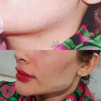 تزریق ژل بوتاکس چال گونه تتو پرسینگ مژه و اموزش|خدمات آرایشگری و زیبایی|اهواز, معین زاده|دیوار