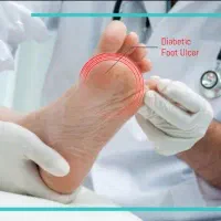 درمان انواع زخم به دست کارشناس زخم حرفه ای