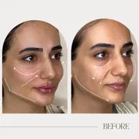 ادیت محتوا اینستاگرام|خدمات رایانه‌ای و موبایل|تهران, چیتگر جنوبی|دیوار