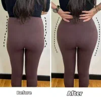 تزریق به بدن هیپ دیپ/مچ پا/دست(هر 100سی سی10میلیون